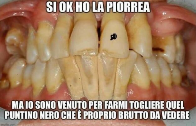 sbiancamento denti Studio Odontoiatrico Scarozza dentista San Giovanni Roma denti bianchi